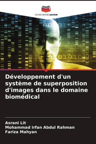Développement d'un système de superposition d'images dans le domaine biomédical