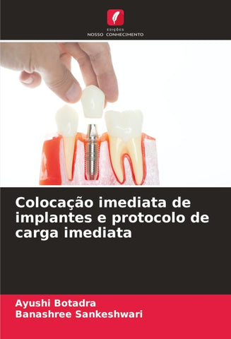 Colocação imediata de implantes e protocolo de carga imediata