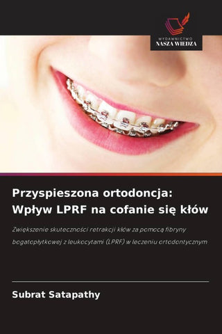 Przyspieszona ortodoncja: Wp¿yw LPRF na cofanie si¿ k¿ów