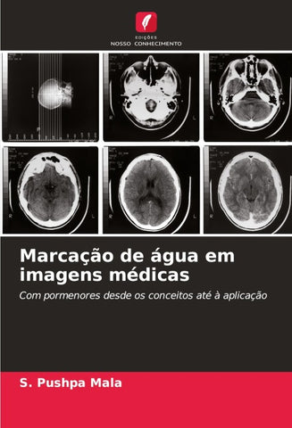 Marcação de água em imagens médicas