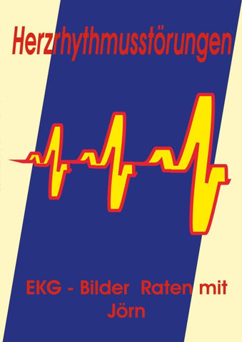 Herzrhythmusstörungen