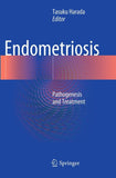 Endometriosis