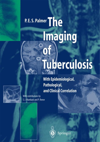 The Imaging of Tuberculosis