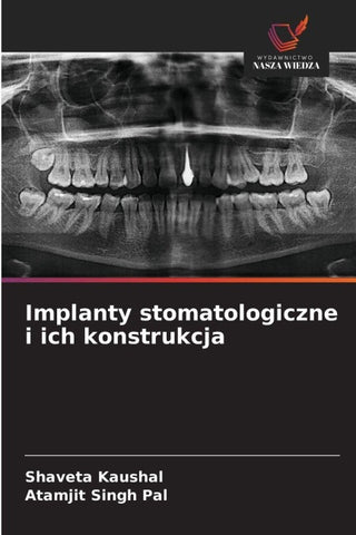 Implanty stomatologiczne i ich konstrukcja