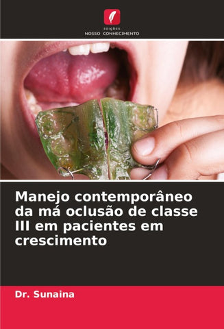 Manejo contemporâneo da má oclusão de classe III em pacientes em crescimento