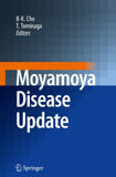 Moyamoya Disease Update