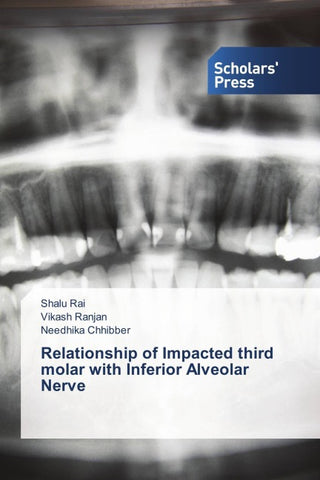 Relationship of Impacted third molar with Inferior Alveolar Nerve