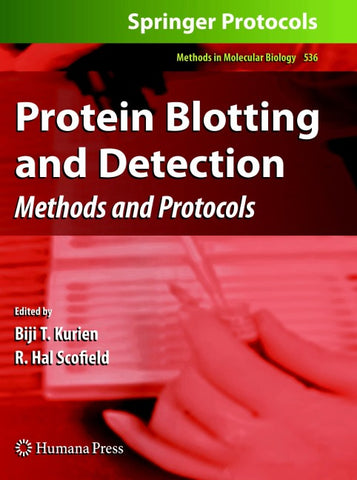 Protein Blotting and Detection