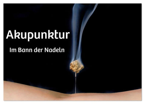 Akupunktur - Im Bann der Nadeln (Wandkalender 2026 DIN A2 quer), CALVENDO Monatskalender