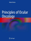 Principles of Ocular Oncology