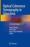 Optical Coherence Tomography in Glaucoma