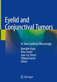 Eyelid and Conjunctival Tumors