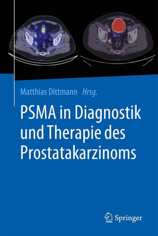 PSMA in Diagnostik und Therapie des Prostatakarzinoms