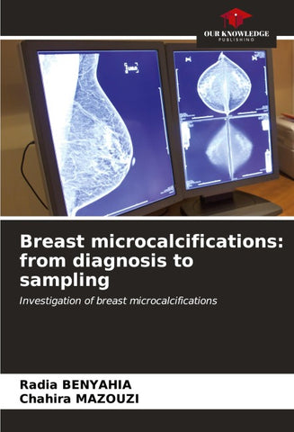 Breast microcalcifications: from diagnosis to sampling
