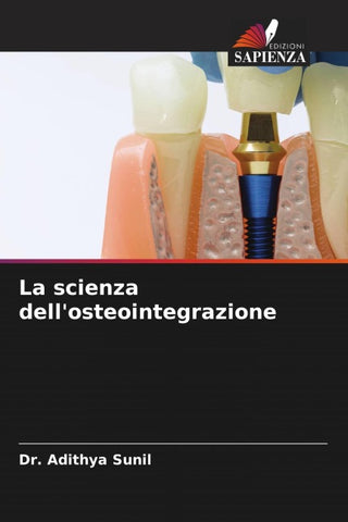 La scienza dell'osteointegrazione