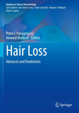 Hair Loss