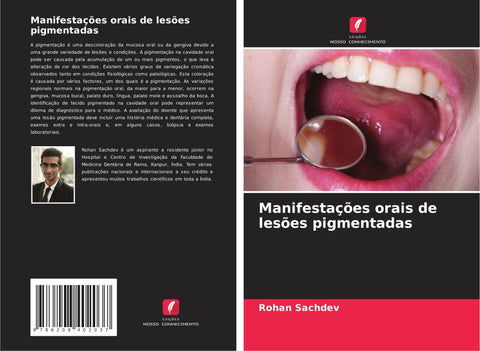 Manifestações orais de lesões pigmentadas