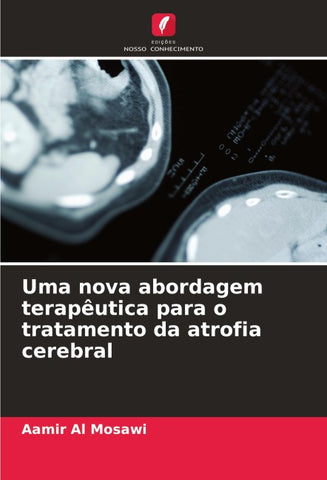 Uma nova abordagem terapêutica para o tratamento da atrofia cerebral