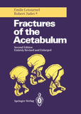 Fractures of the Acetabulum