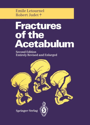 Fractures of the Acetabulum