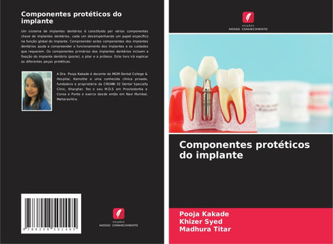 Componentes protéticos do implante