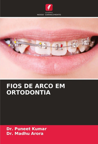FIOS DE ARCO EM ORTODONTIA
