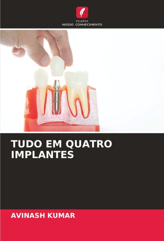 TUDO EM QUATRO IMPLANTES