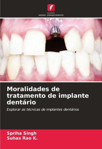 Moralidades de tratamento de implante dentário