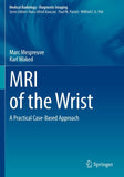 MRI of the Wrist