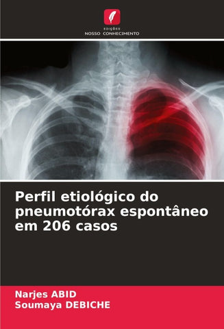 Perfil etiológico do pneumotórax espontâneo em 206 casos