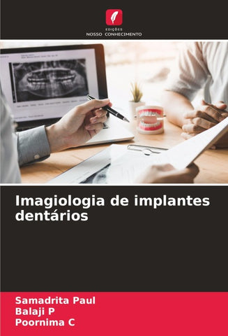 Imagiologia de implantes dentários