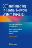 OCT and Imaging in Central Nervous System Diseases