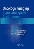Oncologic Imaging: Spine and Spinal Cord Tumors
