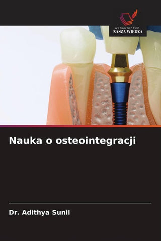 Nauka o osteointegracji