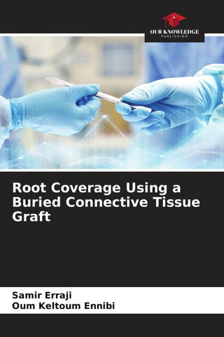 Root Coverage Using a Buried Connective Tissue Graft