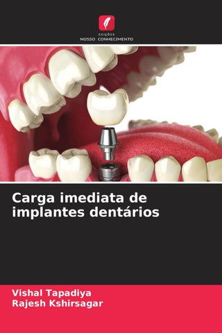 Carga imediata de implantes dentários