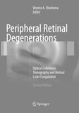 Peripheral Retinal Degenerations