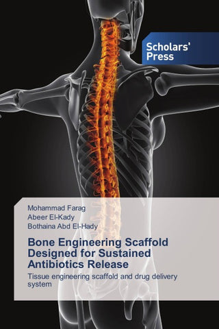 Bone Engineering Scaffold Designed for Sustained Antibiotics Release