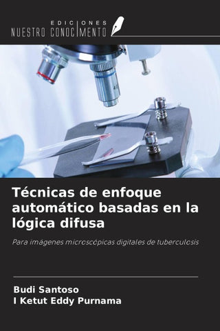 Técnicas de enfoque automático basadas en la lógica difusa