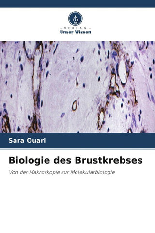 Biologie des Brustkrebses