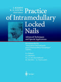 Practice of Intramedullary Locked Nails