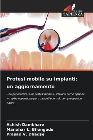 Protesi mobile su impianti: un aggiornamento