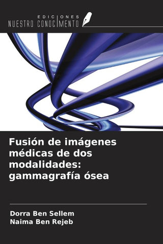 Fusión de imágenes médicas de dos modalidades: gammagrafía ósea