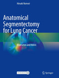 Anatomical Segmentectomy for Lung Cancer
