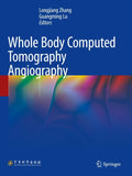 Whole Body Computed Tomography Angiography
