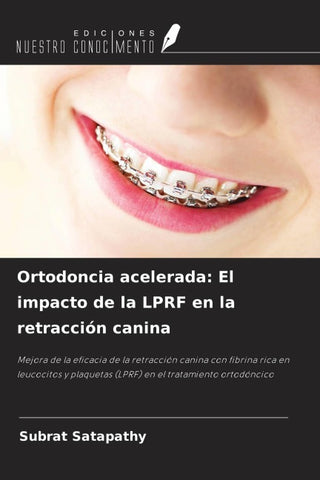 Ortodoncia acelerada: El impacto de la LPRF en la retracción canina