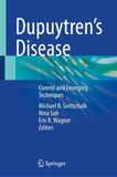 Dupuytren's Disease