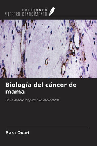 Biología del cáncer de mama