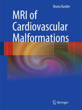 MRI of Cardiovascular Malformations