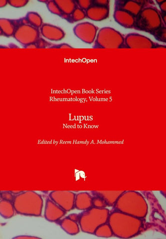 Lupus
